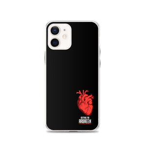 Beating for Arbaeen - iPhone Case
